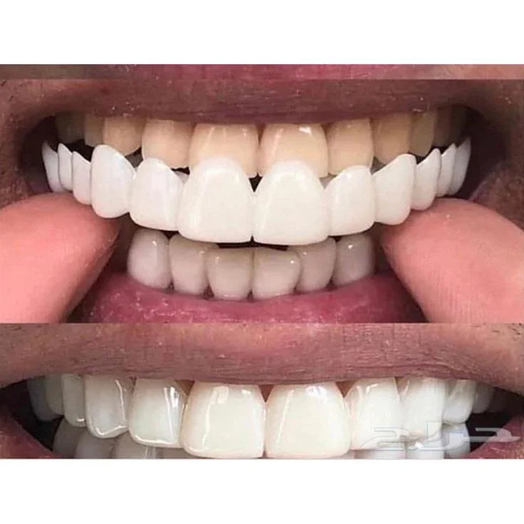 IMPORTED Snap-On Teeth Veneers ........