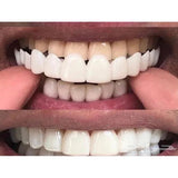 IMPORTED Snap-On Teeth Veneers ........