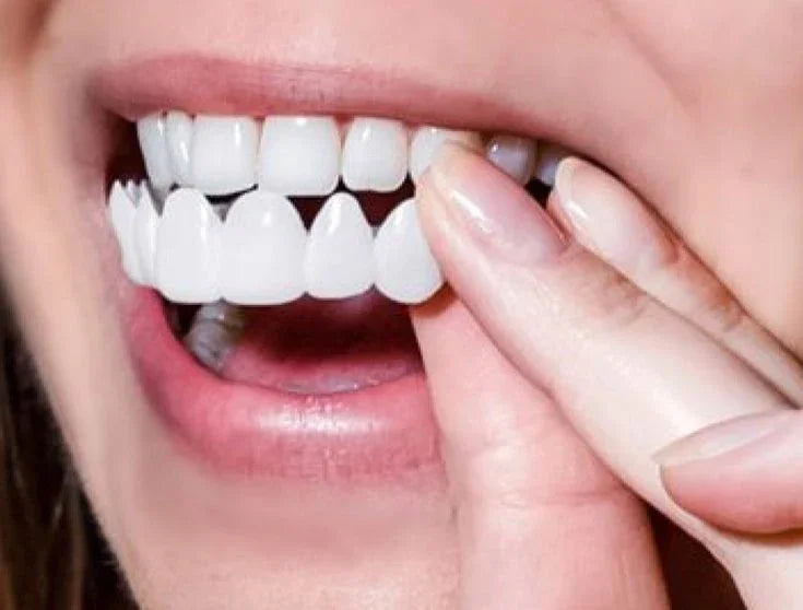 IMPORTED Snap-On Teeth Veneers ........
